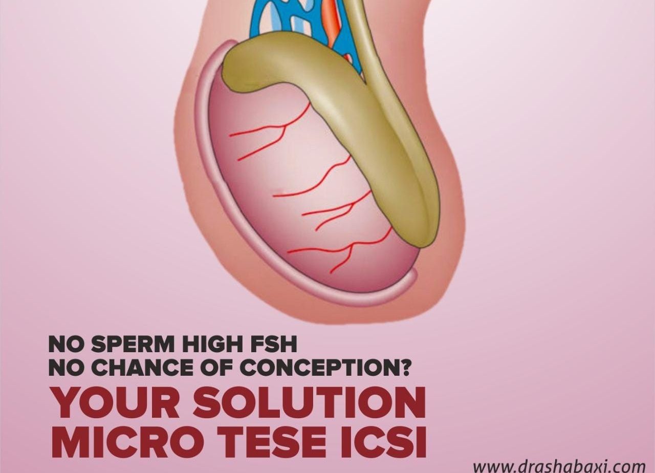 Microdissection Testicular Sperm